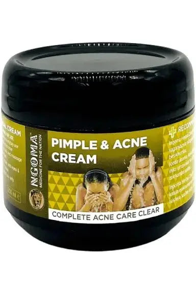 Ngoma pimple & acne cream
